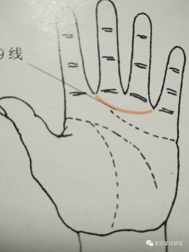 掌纹诊病—掌纹14条线