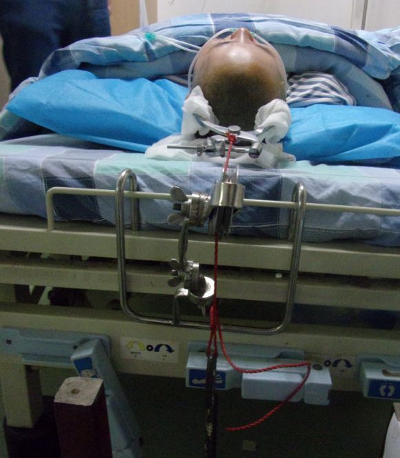 深圳市中医院骨三科医生再闯死亡禁区!