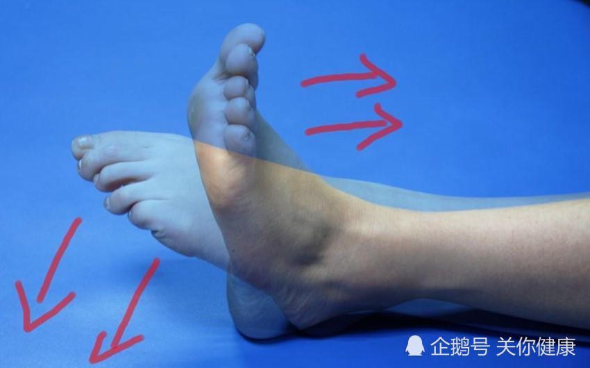健康过大年,多做踝泵运动可减少血栓发生风险