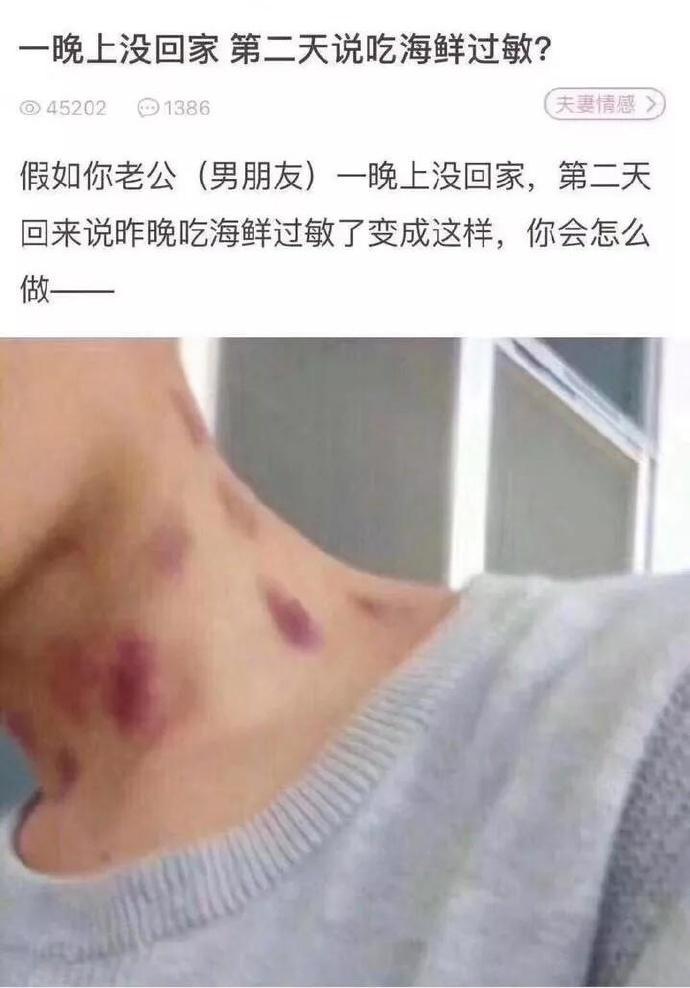 假如你的老公一夜未归,说脖子上的印记是海鲜