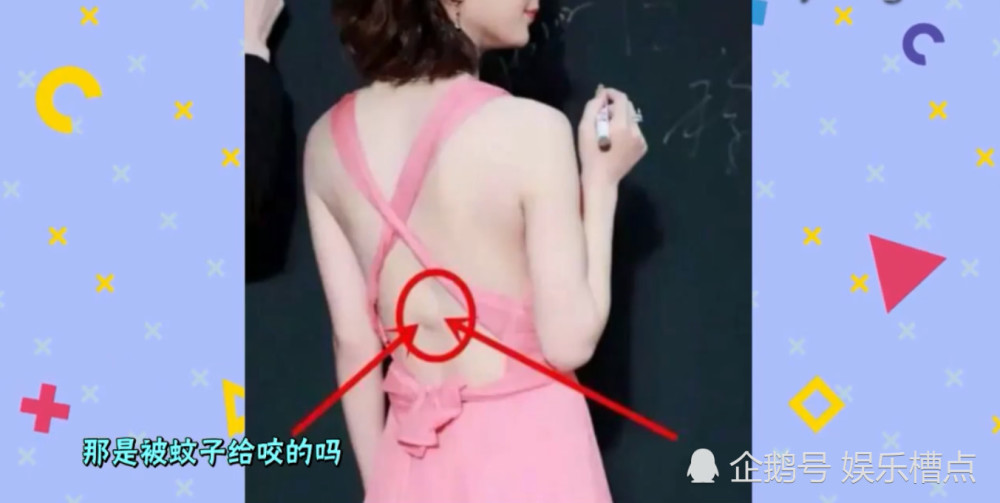赵丽颖后背现大包?只因演戏受伤