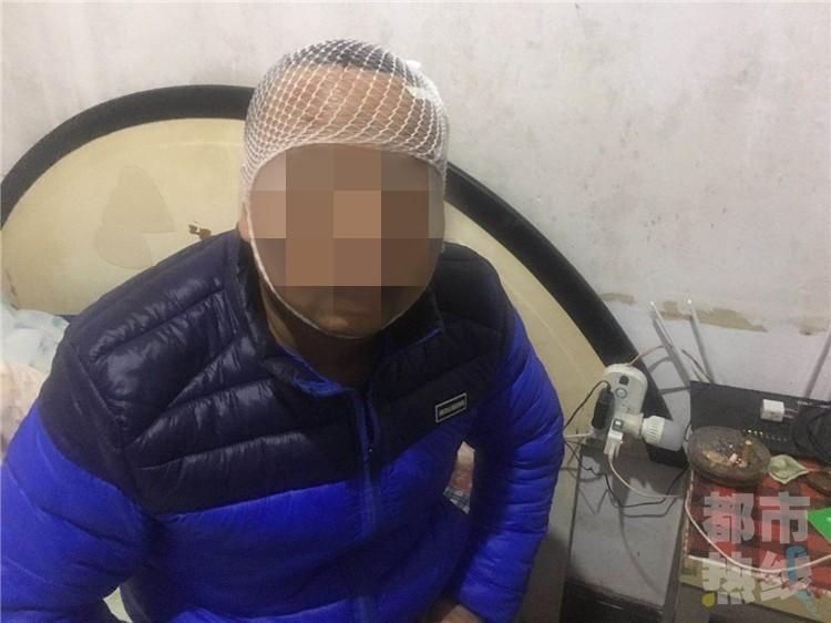 朋友聚会酒后起争执 男子头上缝四针