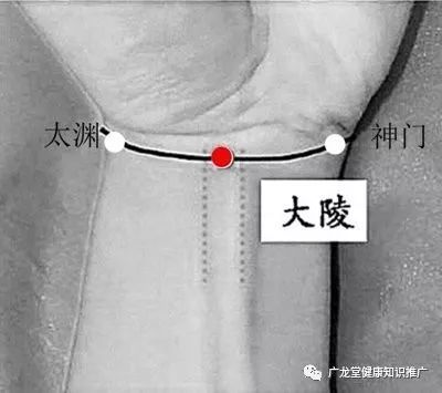 广龙堂穴位篇--大陵与内关!