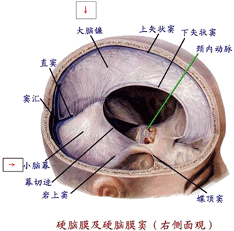5,先天因素,如小脑扁桃体下疝畸形.