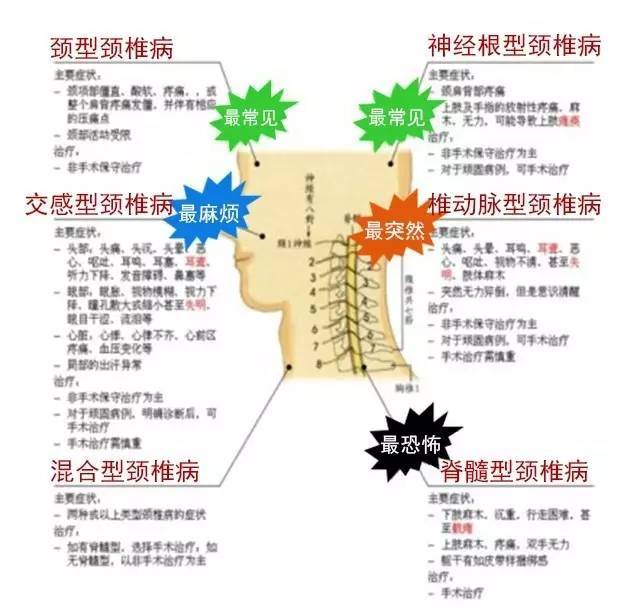 让你深层了解交感神经颈椎病