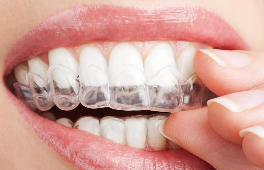 我们找到刘亦菲颜值忽高忽低的原因了!