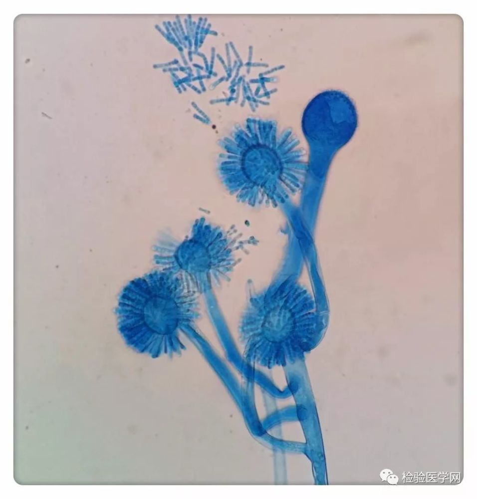 最美真菌,非你莫属-花开并蒂共头霉