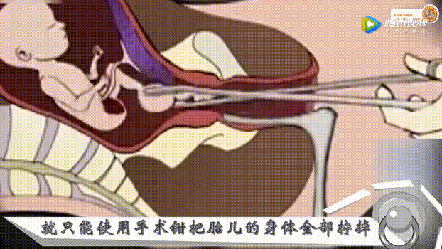 假如给你100万你敢生三胎吗
