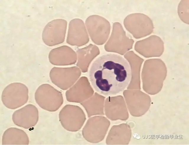 1 中性粒细胞,分叶核 a.1.2 细胞核与细胞浆比率为1:3.