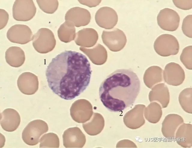 常见外周血白细胞形态学
