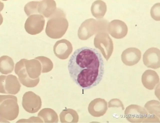 常见外周血白细胞形态学