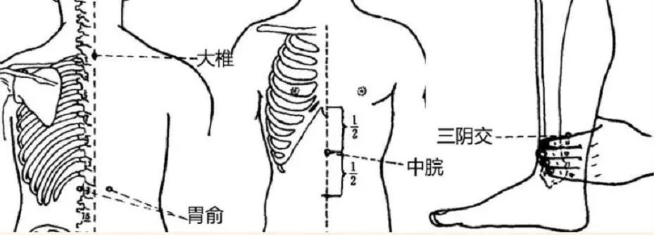 中脘:可以和胃健脾,消积化滞,多用于治疗脾胃病,黄疸 ..