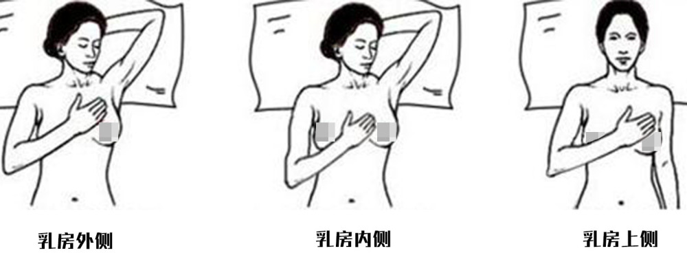 乳腺癌:妇科头号恶性肿瘤,乳房自检从现在做起