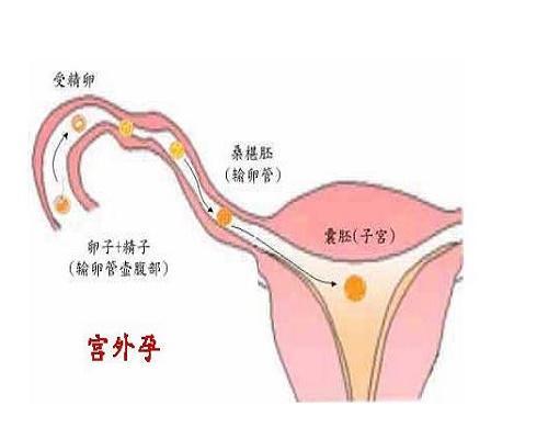 å®«å¤å­ççç¶