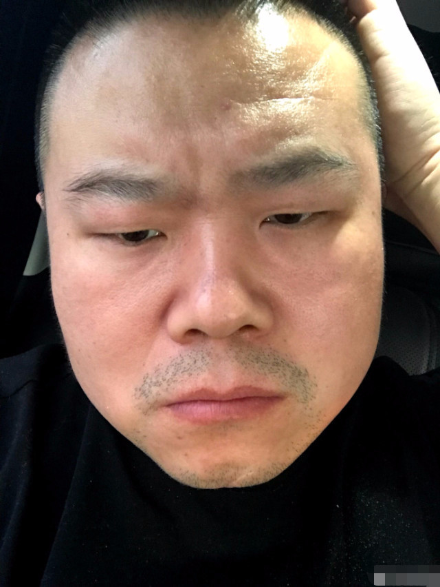 岳云鹏微博找裁缝,希望做一个可以遮住他大腮帮子的口罩,网友神推荐