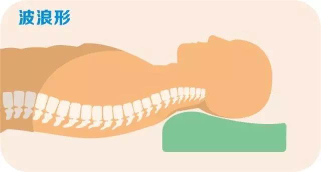 这类枕头对颈椎危害大?90%的人都睡错了!