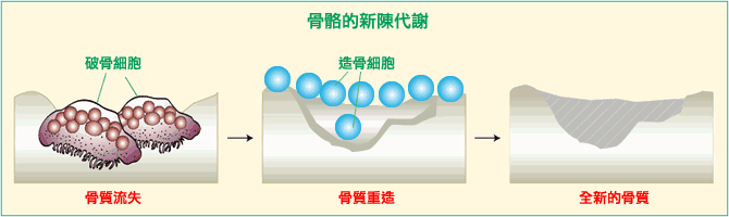 【成都治疗骨关节病哪个医院好】中老年人如何防治骨质疏松?
