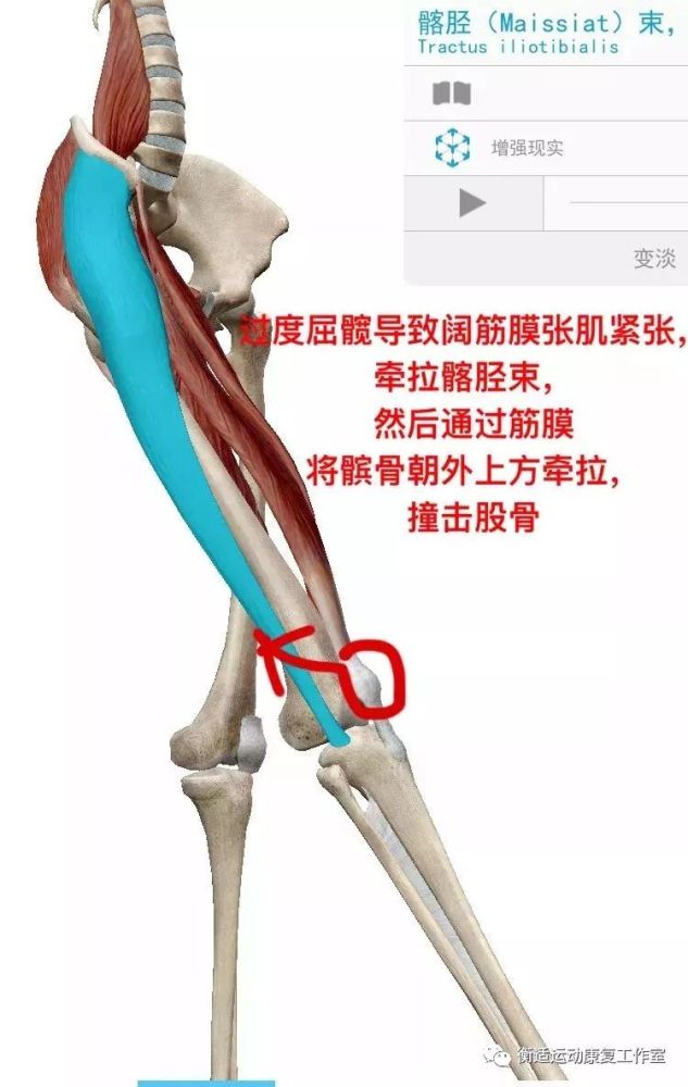 过度的抬腿跨步也使它过度紧张,牵拉髂胫束以及通过筋膜使髌骨向外