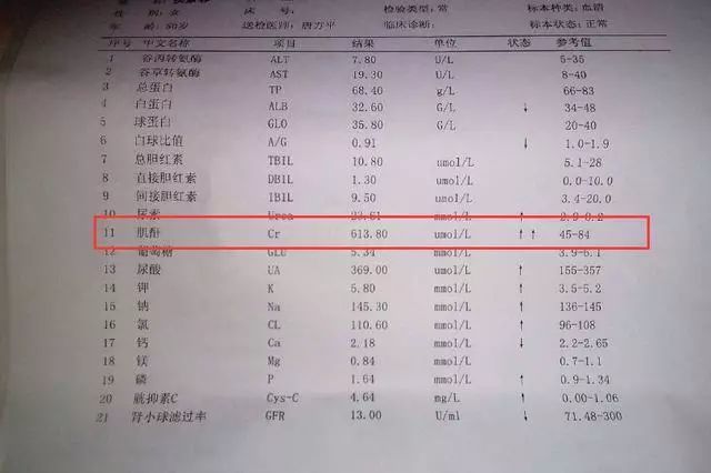 肾病就怕肌酐高,超过707就是尿毒症末期了,专家:3招降