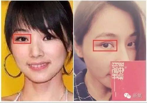 16萬的瘦臉、24萬的雙眼皮，天價(jià)整形背后的秘密！