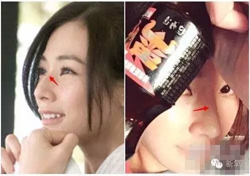 16萬的瘦臉、24萬的雙眼皮，天價(jià)整形背后的秘密！