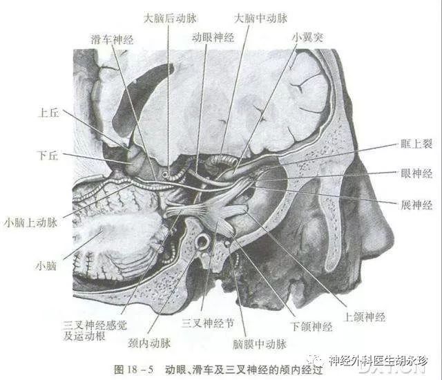 小脑幕切迹及其周围解剖关系