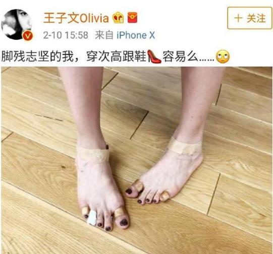女明星那些惨不忍睹的脚,金星的充满了故事,赵丽颖最命苦!