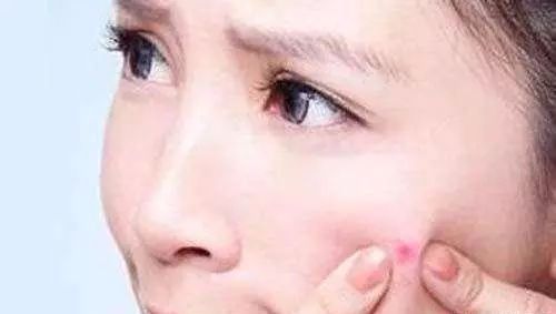 去黑头的护肤品已用尽 但正确的方法你却不知道 看点快报