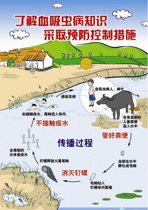 如不及时治疗,可发展为晚期血吸虫病,出现肝脾肿大,腹水等症状,严重