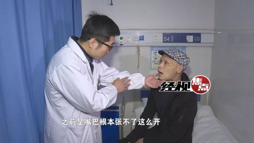 长沙一男子口腔疼痛舌头又麻又疼 医院确诊为口腔癌