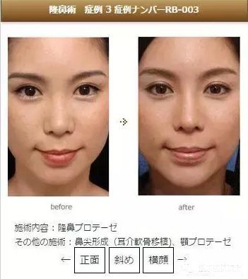 日本整容好厉害啊 看点快报