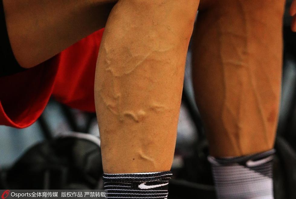 男篮备战阿联腿部爆青筋 周琦冰敷膝盖