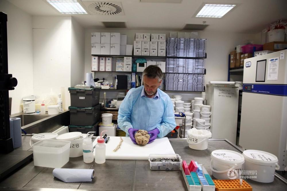 科学家研究脑神经疾病 切脑如切菜