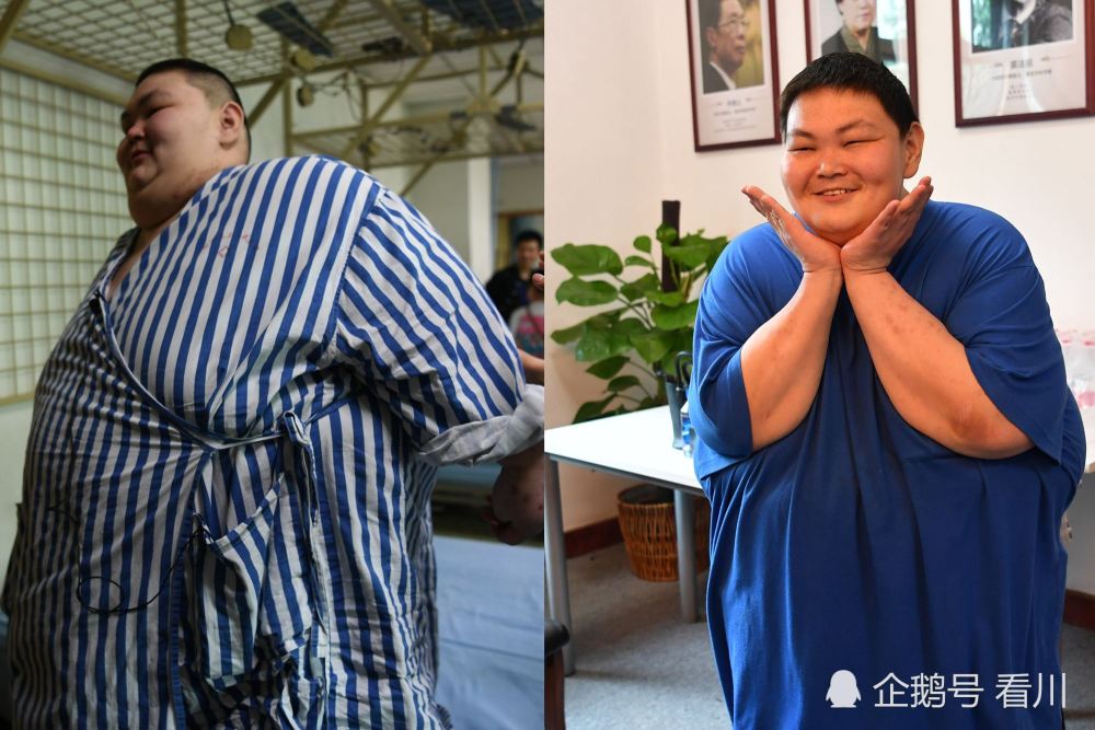 "中国第一胖"从530斤减到330斤,曾经穿过的衣服被玩儿