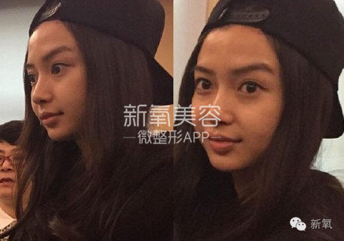 整成Angelababy的网红们，简直傻傻分不清