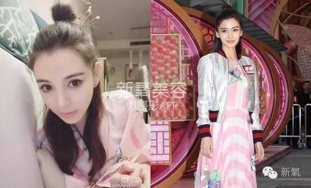 整成Angelababy的网红们，简直傻傻分不清