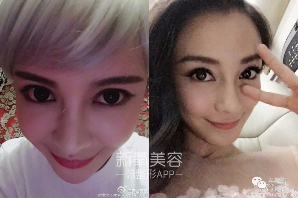 整成Angelababy的网红们，简直傻傻分不清