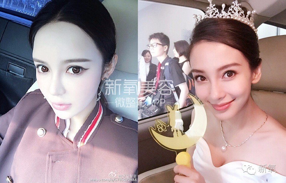 整成Angelababy的网红们，简直傻傻分不清