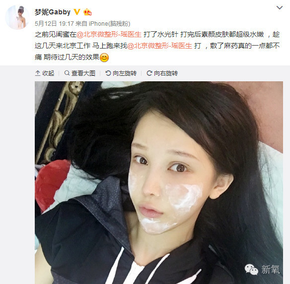 整成Angelababy的网红们，简直傻傻分不清