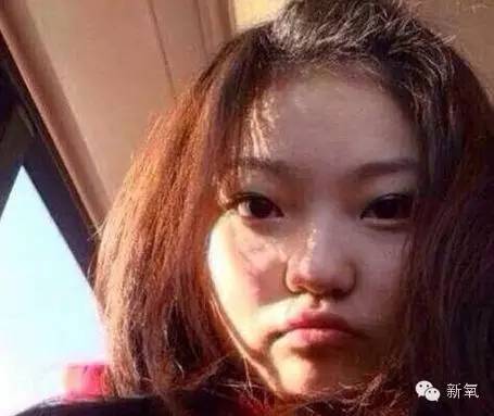 整成Angelababy的网红们，简直傻傻分不清