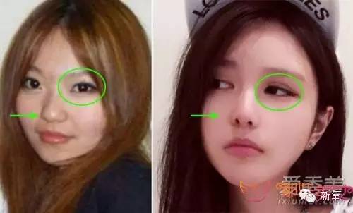 整成Angelababy的网红们，简直傻傻分不清