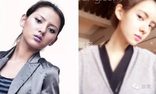 整成Angelababy的网红们，简直傻傻分不清