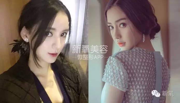 整成Angelababy的网红们，简直傻傻分不清