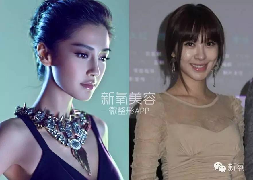整成Angelababy的网红们,简直傻傻分不清
