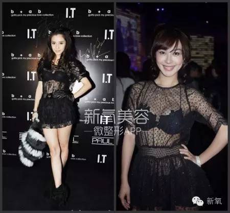 整成Angelababy的网红们，简直傻傻分不清