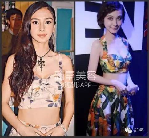 整成Angelababy的网红们，简直傻傻分不清