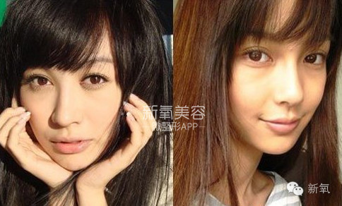 整成Angelababy的网红们，简直傻傻分不清