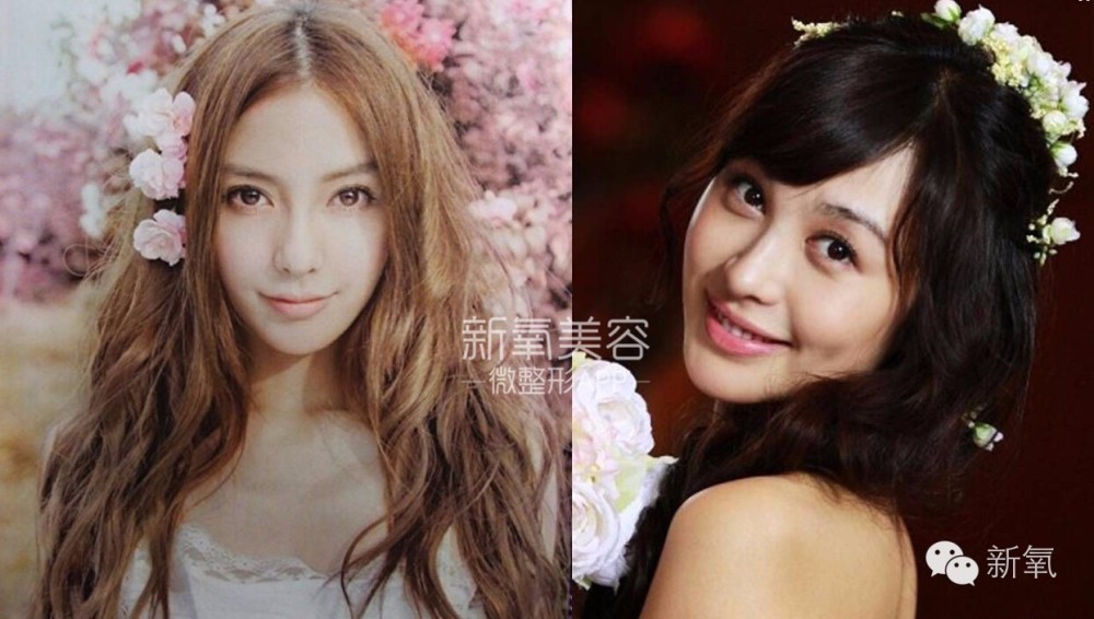 整成Angelababy的网红们，简直傻傻分不清