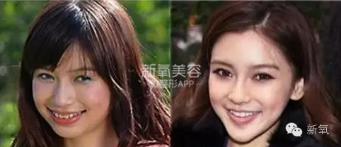 整成Angelababy的网红们，简直傻傻分不清