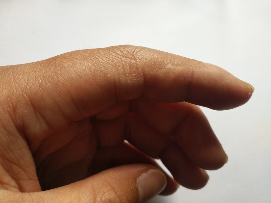 手指上有疤代表着什么,拇指食指中指无名指小指各有不